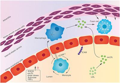 Inflammation—The new treatment target for ischaemic stroke prevention